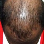 Papua Hair