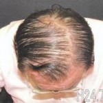 BM Hair before