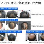 de3d05ff7671eab8d6297990060f5cb2-768×524