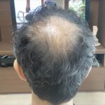 前　8.14.2020