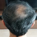 2ヶ月後