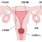 shikyukeigan1