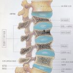 椎体骨折